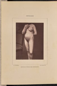 Generaliseret vesikulær syfilis af Arthur de Montmeja