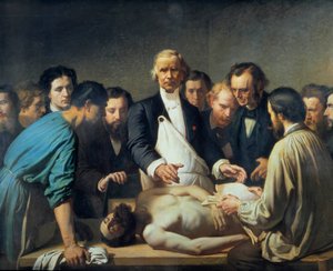 Doktor Alfred Velleau (1795-1867) hos Charity vil gå videre til en obduktion. En læge omgivet af sine elever, som er parat til at gribe ind over for et lig. Maleri af Francois Feyen Perrin (1826-1888). 19. århundrede. Tours musee des Beaux Arts - Alfred Ve af Auguste (after) Feyen Perrin