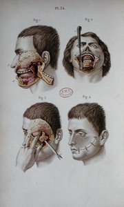 Anatomisk plade af overkæben af C and Huette E. Bernard