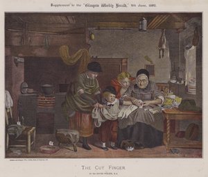 The Cut Finger (farve litho)