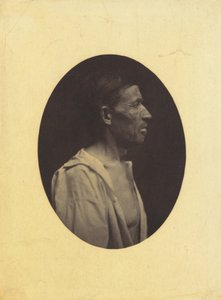 Et portræt, set i profil, af en mand 42 år gammel, bedøvet over misbrug af alkohol..., 1854-1856.