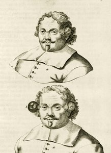 Et eksempel på cupping, fra The Practice of Medicine af Frederik Dekkers, 1694 af Dutch School