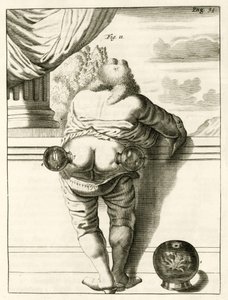 Et eksempel på cupping, fra The Practice of Medicine af Frederik Dekkers, 1694 af Dutch School