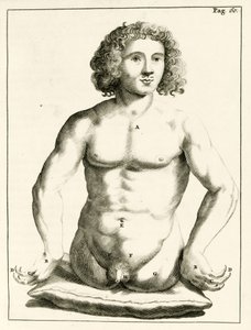 Eksempel på medfødte misdannelser af Frederik Dekkers, 1694 af Dutch School