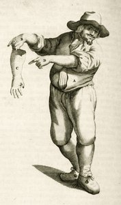Fjernelse af død hud med pustler, fra Practical Exercises in Medical Methods af Frederik Dekkers, 1694 af Dutch School