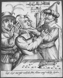 Trepanning, graveret af H. Weydmans (1500-tallet) af Dutch School