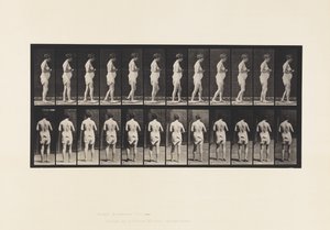 Plade 542. Multipel Cerebro-Spinal Sklerose - Gå af Eadweard Muybridge