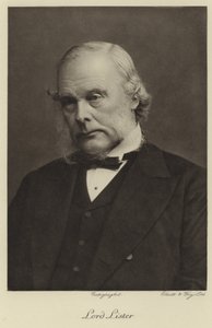 Joseph lister af English Photographer