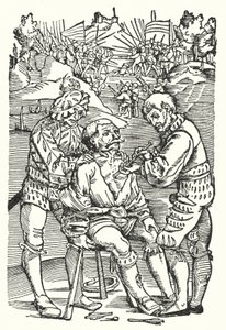 Barberkirurg, der fjerner en pil (gravering) af European School