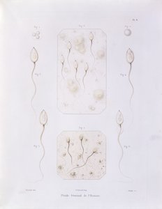 Sædvæske, fra Theorie Positive de lOvulation Spontanee et de la Fecondation des Mammiferes et de lEspece Humaine af Felix-Archimede Pouchet (1800-72) graveret af Oudet, Paris, 1847 (farvet eng. af Felix Archimede Pouchet
