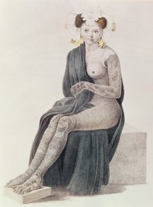 Kongenital Ichthyosis, fra en bog af G.M. Olbers, 1830 af French School