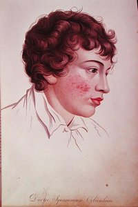 Tør plaster, fra 