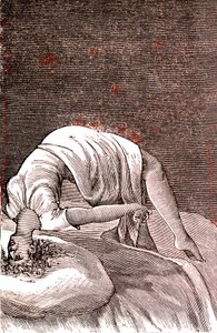 Hysteri, mental og nervøs lidelse, der stammer fra intens angst. 1887 (gravering) af French School