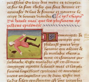 Fru 22532 Patient, der lider af et epileptisk anfald, fra The Book of the Properties of Things af Barthelemy langlais, ca. 1410-15 af French School