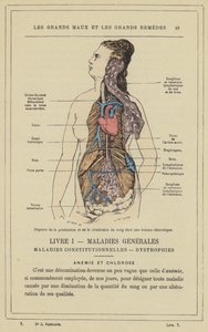 Organer for blodproduktion og cirkulation hos en klorotisk kvinde (farve litho) af French School