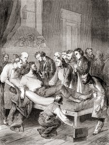 Den første offentlige demonstration af brugen af inhaleret ether som et kirurgisk bedøvelsesmiddel i 1846 af en amerikansk tandlæge, William Thomas Green Morton, fra 