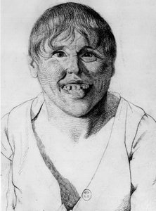 Cretine, -i ""Study of the physiognomy of aliens"", tegning af Gabriel