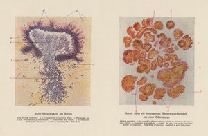 Actinomyces bovis (farvelitografi) af German School