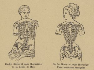 Sammenligning af formen af brystet og brystkassen på Venus de Milo med formen af en fransk socialite fra det sene 19. århundrede af German School