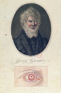Georg Gamber, en albino af German School