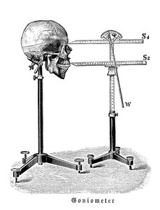 Goniometer, der måler menneskeskalle af German School