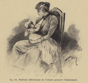 Forkert position af en baby under amning af German School