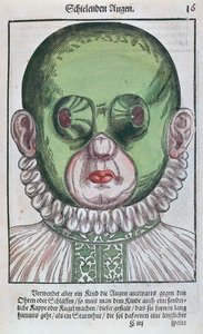 Maske til behandling af strabismus, fra Ophthalmodouleia af Georg Bartisch (1535-1636) udgivet i Dresden i 1583 (træblok i farver) af German School
