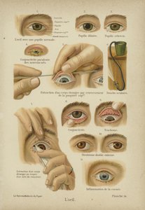 Øjet (farve litho) af German School