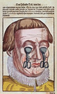 Behandling af en øjensygdom, fra Ophthalmodouleia af Georg Bartisch (1535-1636) udgivet i Dresden i 1583 (træblok i farver) af German School