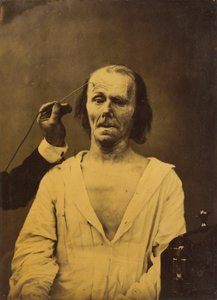 Et afslappet ansigt (til venstre); dyb opmærksomhed (til højre),1854-1856, trykt 1862 (foto)