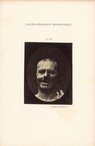 Fotografisk elektrofysiologi, figur 53 af Guillaume Benjamin Duchenne