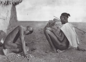 Afrika: Medicinmand bløder en patient (s/h-foto) af Hugo Adolf Bernatzik