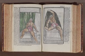 Kvindelig anatomi, fra kommentarer til verdens anatomi med de største tilføjelser, af Jacopo Berengario da Carpi (ca. 1460-c. 1530) udgivet i Bologna, 1521 (farvet træbloktryk) af Italian School