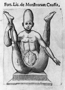Menneskeligt monster: et væsen med et enormt kranium, med synlige tarme. Indgravering fra "Monstrenes natur, årsager og forskelle" af Fortunio Liceti (1577-1656), italiensk videnskabsmand. 1646 af Italian School