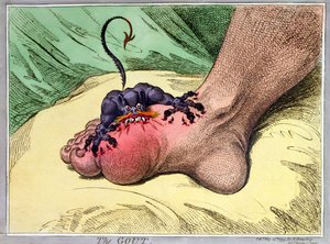 The Gout, udgivet af Hannah Humphrey i 1799 (håndfarvet softdground radering)