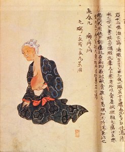 Den første kirurgiske behandling af brystkræft udført under generel anæstesi af Seishu Hanaoka (1760-1836) i 1804 af Japanese School