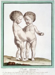 Siamesiske børn - i "" Naturens afvigelser"" af Régnault af Jean Baptiste Regnault