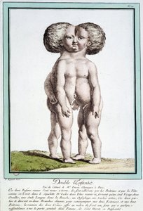 Siamesiske børn - i "" Naturens afvigelser"" af Régnault af Jean Baptiste Regnault