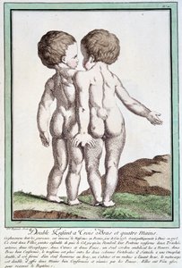 Siamesiske børn - i "" Naturens afvigelser"" af Régnault af Jean Baptiste Regnault