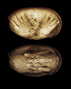 Garnhænder, 2013 (fotomanipulation) af Johan Lilja