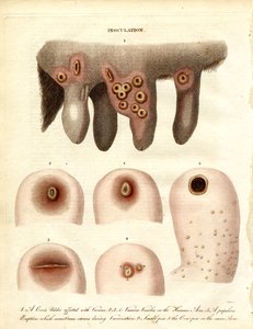 Podning og sygdomsudvikling af John Pass