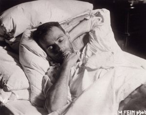 Egon Schiele på sit dødsleje, 1918. af Martha Fein