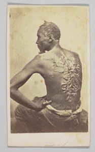 Gordon under medicinsk inspektion, 1863. af McPherson and Oliver