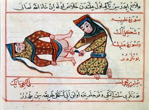 Medicin: operation af en hermaphoditis. Miniature fra en behandling af tyrkisk medicin af Sharaf al-din