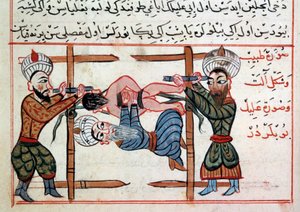 Reduktion af et brud. Miniature fra en behandling af tyrkisk medicin af Sharaf al-din af Ottoman School