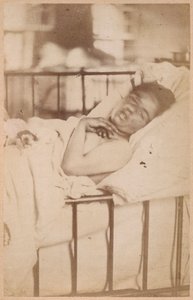 Hysterisk epilepsi, permanent sammentrækning, plade XXVIII fra 