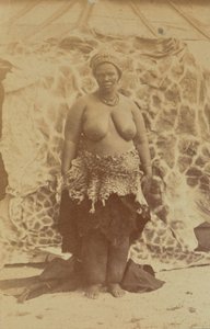 [Sydafrikansk kvinde]