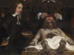 The Anatomy Lesson of Dr. Jan Deyman, 1656dani af Rembrandt van Rijn