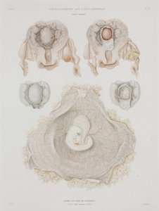 Gynækologi Menneskelig livmoder med embryo, c 1847-1859 af John Pardon