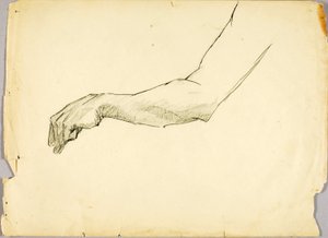 Undersøgelse af arm af Solon H. Borglum